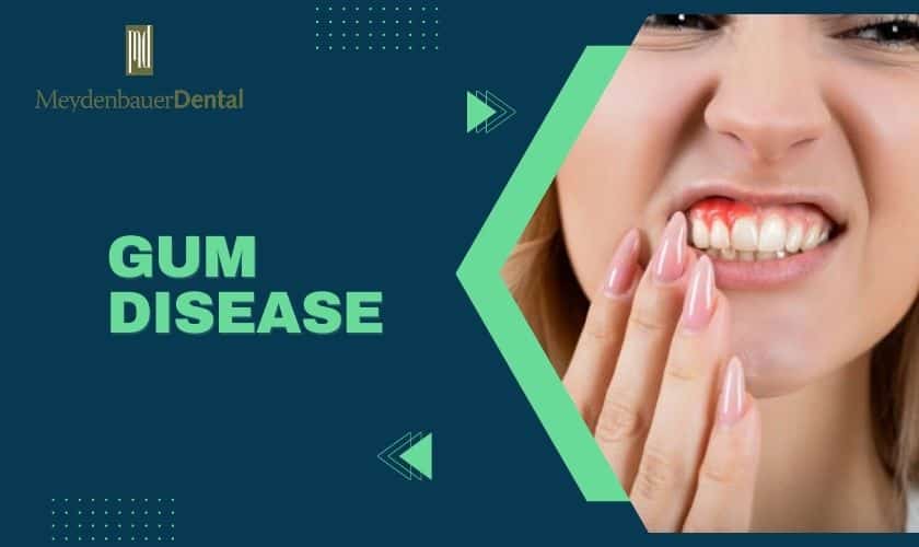 What Are The Signs That Show You Have Gum Disease
