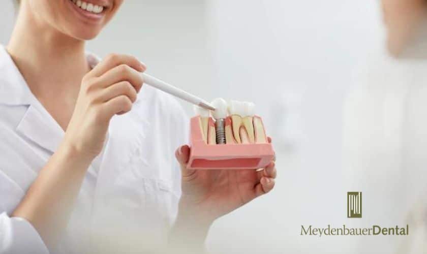 After Dental Implant To Place Restoration