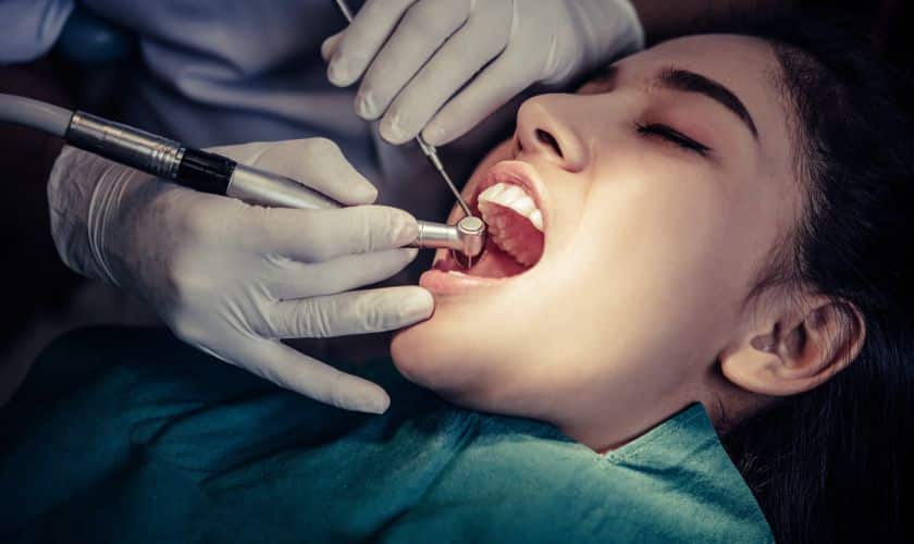Dental Sealants Help Prevent Cavities And Decay