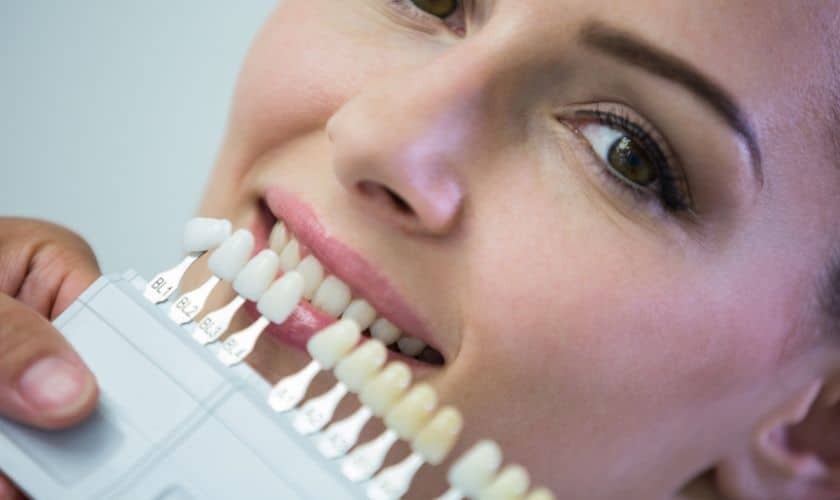 Woman comparing dental veneer shade samples to her natural teeth during consultation.