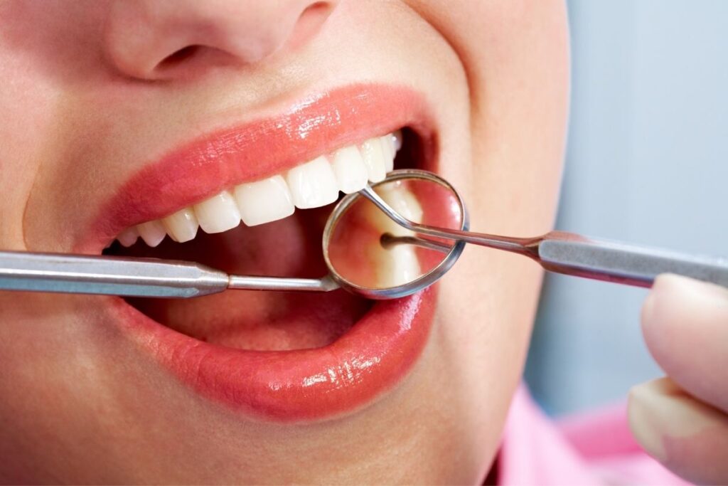 5 Easy Hacks for a Brighter Smile