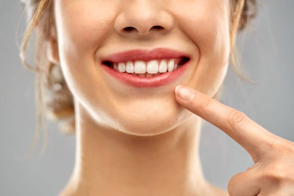 Teeth Whitening Part of Cosmetic Dentistry