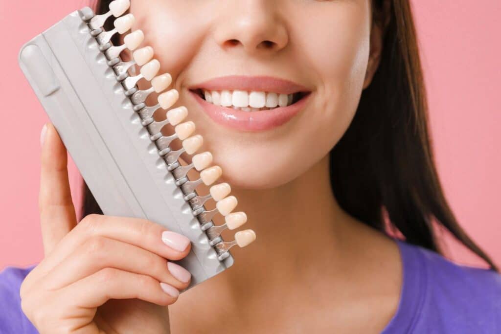 Porcelain veneers for your teeh