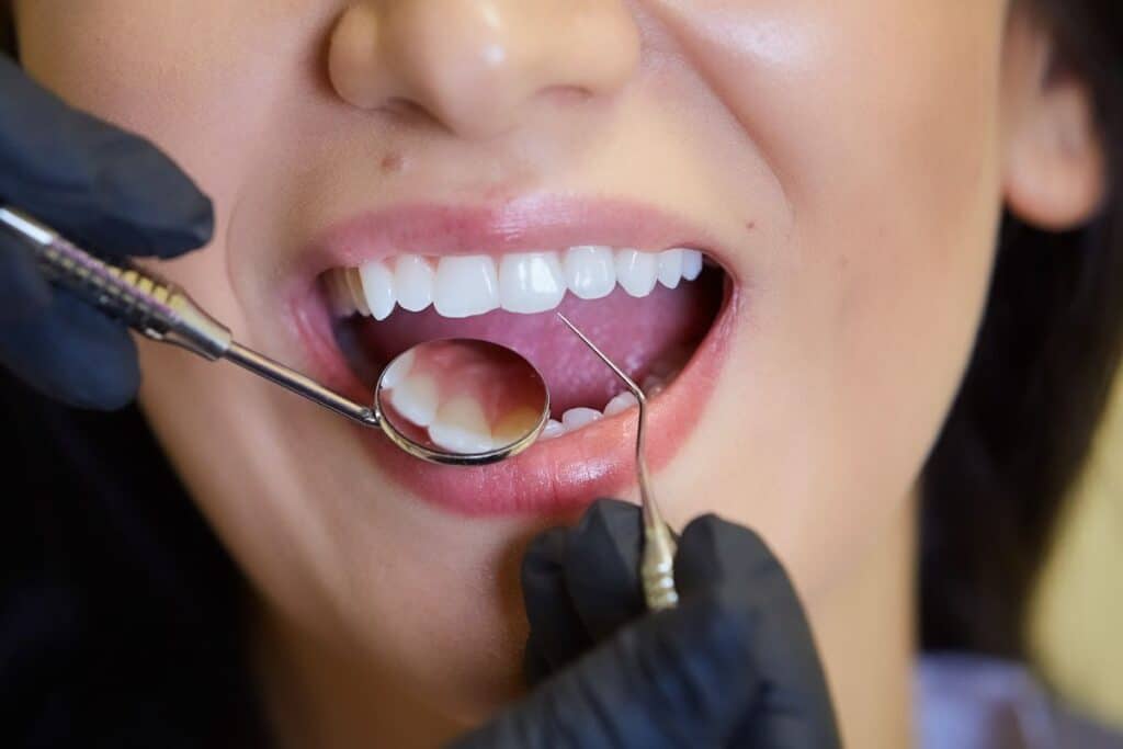 Dental Check-Up