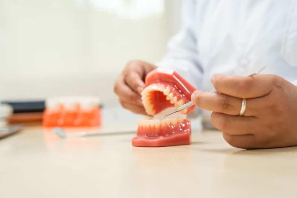 Tooth Cracks treatment