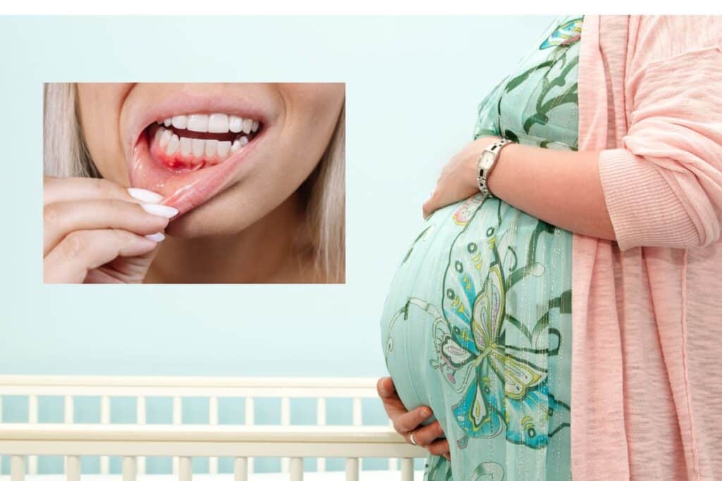 How To Maintain A Healthy Smile During Pregnancy