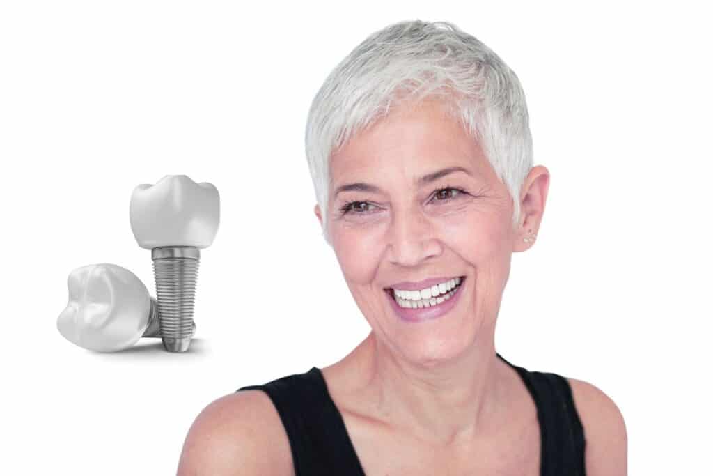 How to Care for Dental Implants