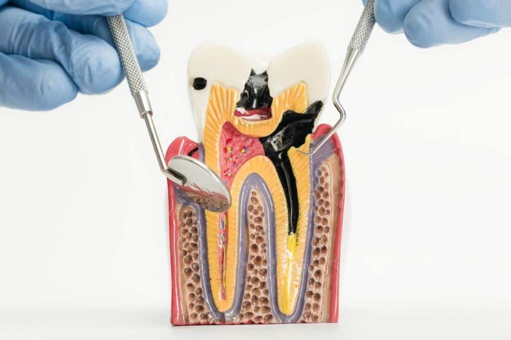 How to Keep Your Dental Pulp Healthy: Prevention Tips from Your Dentist
