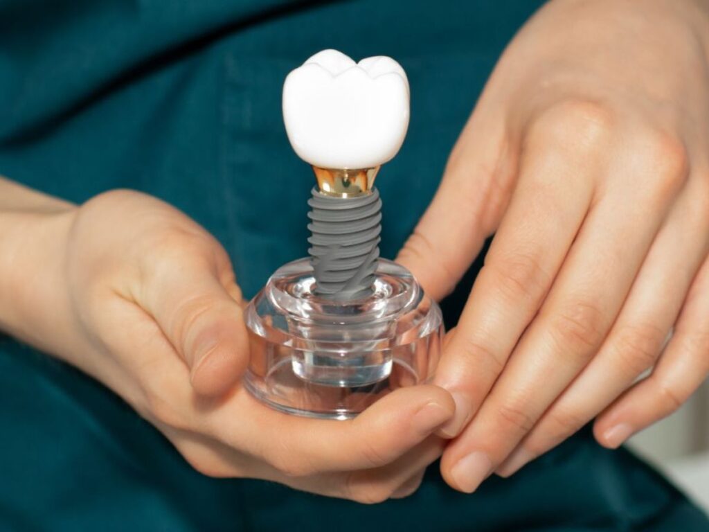 dental implants