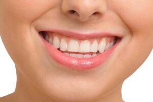 Can White Spots on Teeth Be Reversed Naturally