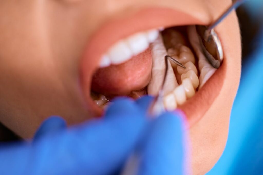 Gum Disease Treatment in Wilburton